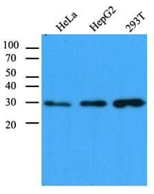 IHC-plus™ CBR / CBR1 Antibody (clone AT4E12)