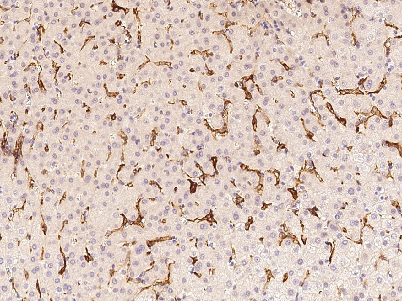Polyclonal Rabbit anti-Human VCAM1 / CD106 Antibody (Preservative Free, IHC)