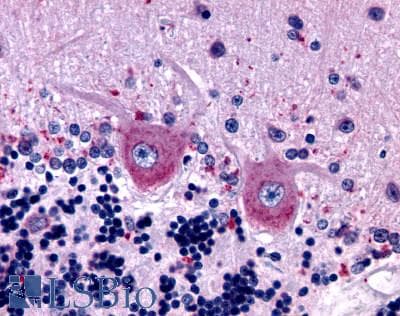 PathPlus™ GABBR1 / GABA B Receptor 1 Antibody (N-Terminus)