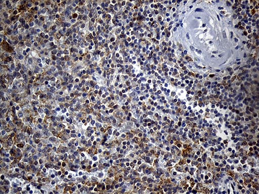 DTWD1 Antibody (clone OTI1D2)