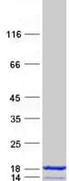 Human S100A7 / Psoriasin Protein (Recombinant Myc-DDK (Flag))