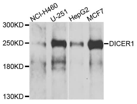 Polyclonal Rabbit anti-Human DICER1 / Dicer Antibody (IHC, WB)