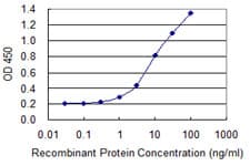 PPP6C Antibody (clone 1B7)