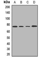 Polyclonal Rabbit anti-Human AGPS Antibody (WB)