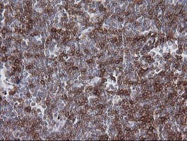CD1C Antibody (clone OTI2B3)