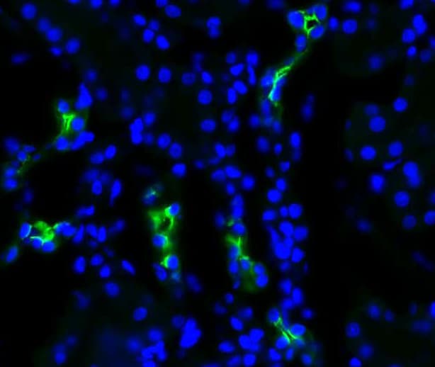 AQP2 / Aquaporin 2 Antibody