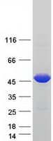 Human NARF Protein (Recombinant Myc-DDK (Flag))