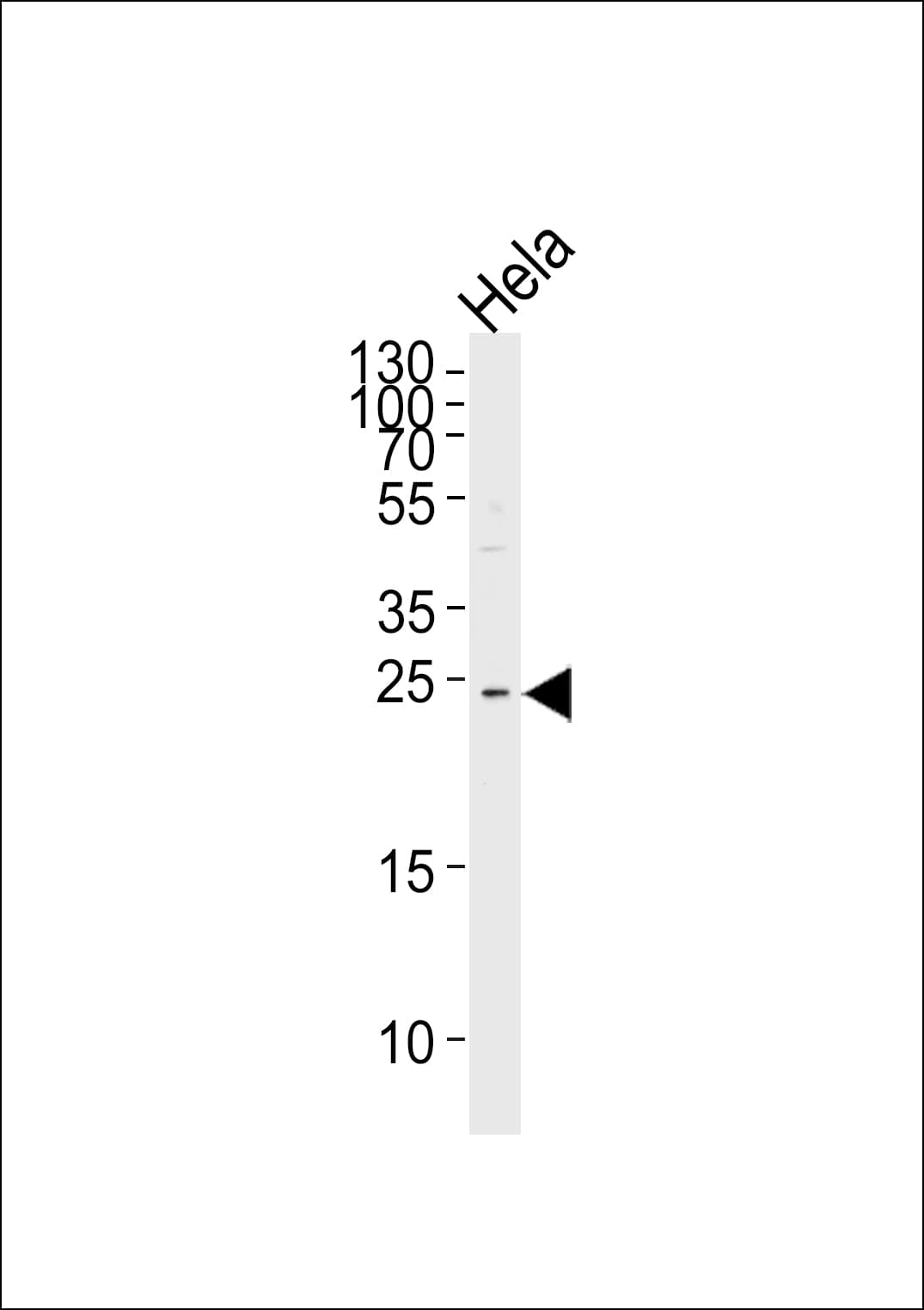 Polyclonal Rabbit anti-Human MOB2 Antibody (aa5-32, IHC, WB)