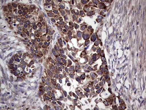 MTDH / Metadherin Antibody (aa70-582, clone OTI1H1)