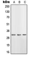 HSD11B1 / HSD11B Antibody (N-Terminus)