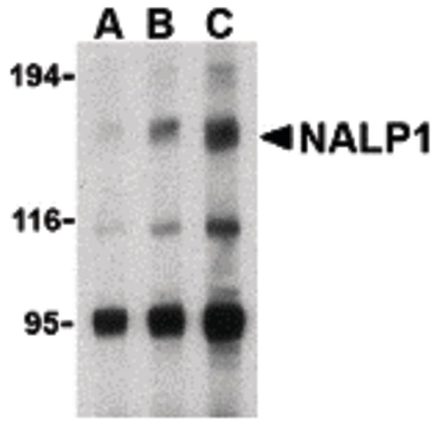 IHC-plus™ Polyclonal Rabbit anti-Human NALP1 / NLRP1 Antibody (IHC, IF, WB)