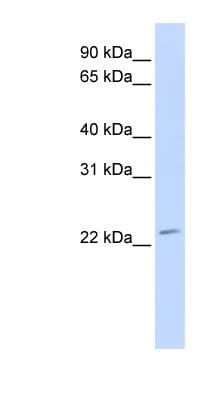 FGF21 Antibody (N-Terminus)