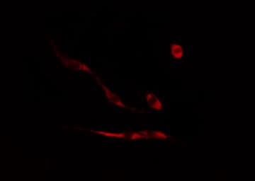 Polyclonal Rabbit anti-Human UTP14A Antibody (IF, WB)