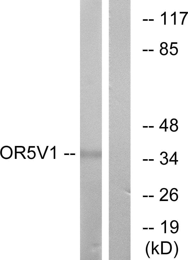 OR5V1 Antibody