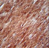 IL2 Antibody (aa50-77)
