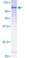 Human MAN1A2 Protein (Recombinant GST)
