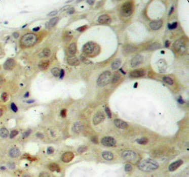 AR / Androgen Receptor Antibody (phospho-Ser650)