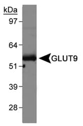 SLC2A9 / GLUT9 Antibody (Internal, Biotin)