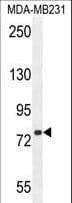 Polyclonal Rabbit anti-Human SORBS1 / Ponsin Antibody (aa866-892, IF, WB)