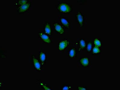 Polyclonal Rabbit anti-Human SAV1 / WW45 Antibody (IHC, IF, WB)