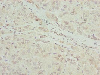 Polyclonal Rabbit anti-Human RIBC2 Antibody (IHC, WB)