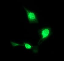 PathPlus™ CD163 Antibody (clone 1B4)