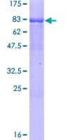 Human RORC / ROR Gamma Protein (Recombinant GST)