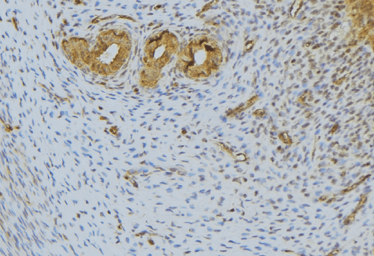 FGF10 Antibody