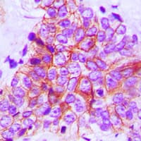 FGFR1OP / FOP Antibody (C-Terminus)