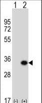 Polyclonal Rabbit anti-Human GCLM Antibody (aa246-274, IHC, IF, WB)