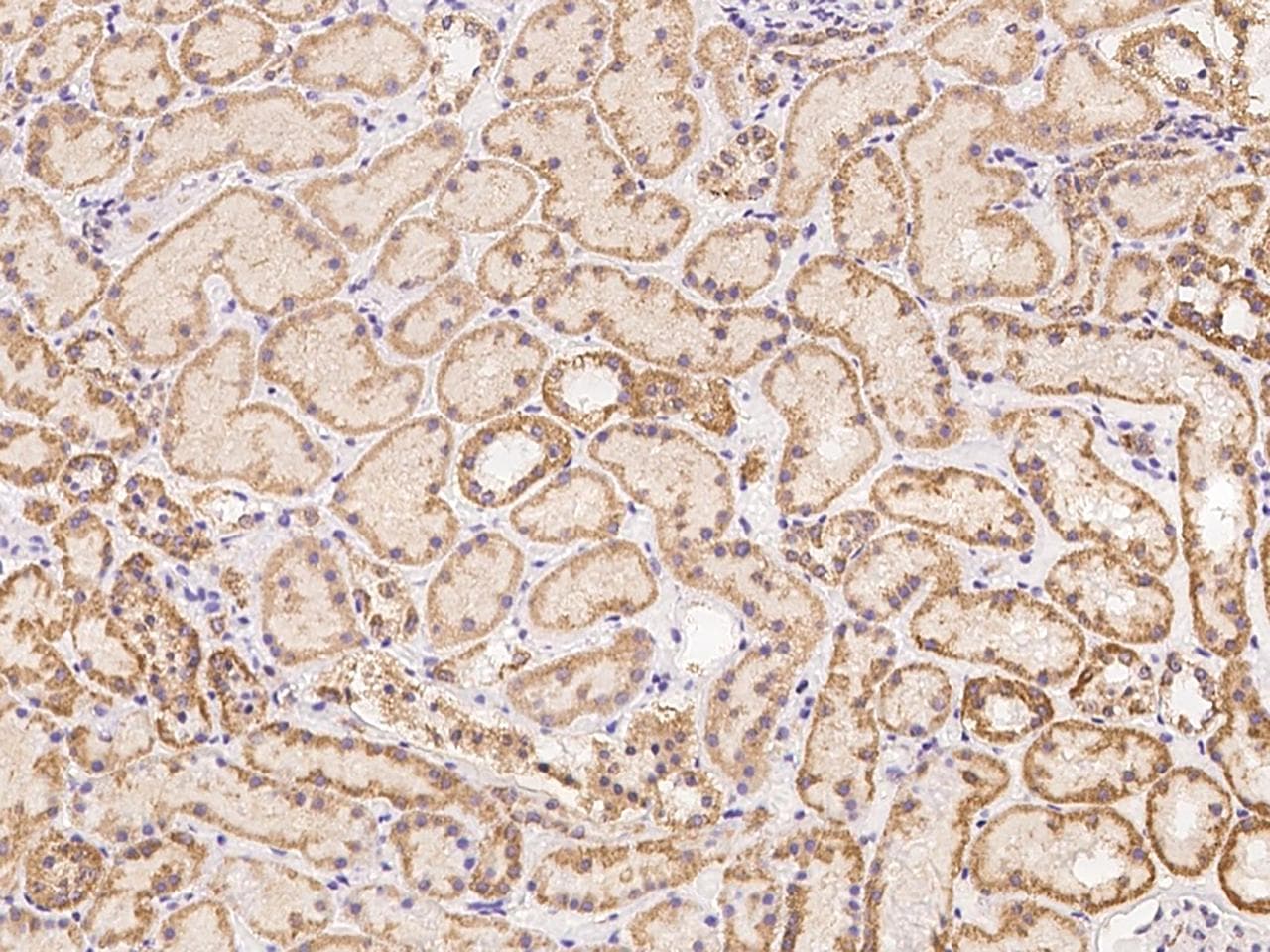 Polyclonal Rabbit anti-Human ZFP28 Antibody (IHC)