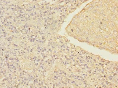 Polyclonal Rabbit anti-Human MRRF Antibody (IHC)
