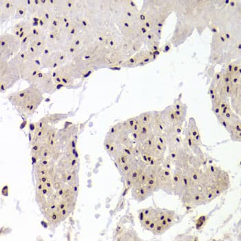 XRCC6 / Ku70 Antibody