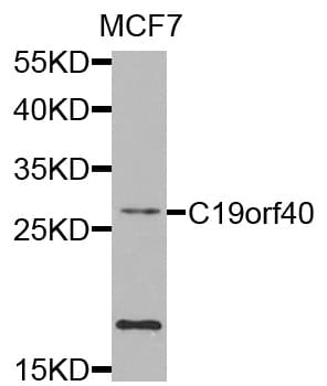 FAAP24 Antibody (AP)