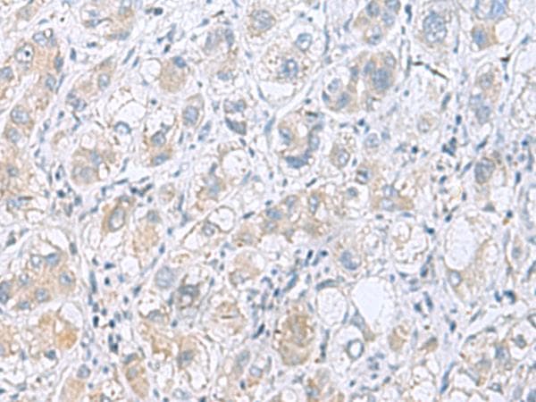Polyclonal Rabbit anti-Human KIAA1434 protein Antibody (IHC, WB)