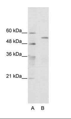 TRIM35 Antibody (aa145-194)