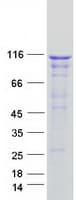 Human KANK3 Protein (Recombinant Myc-DDK (Flag))