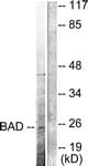 BAD Antibody (aa21-70)