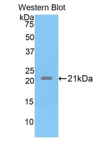 PPARD / PPAR Delta Antibody (aa260-426)