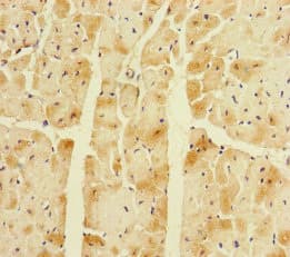 Polyclonal Rabbit anti-Human CORIN Antibody (IHC, WB)