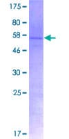 Human RPL7 / Ribosomal Protein L7 (Recombinant GST)