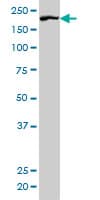 Rho Kinase / ROCK1 Antibody (clone 2E2)
