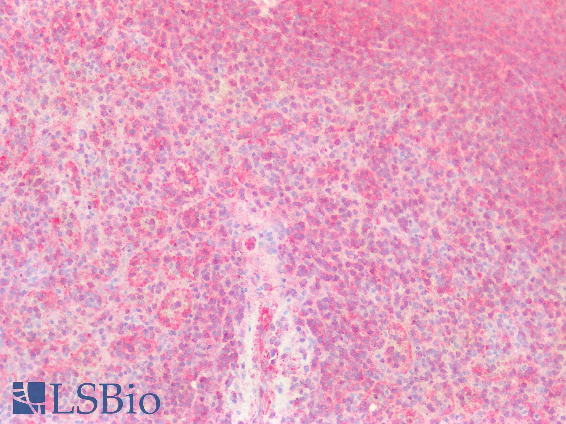 PathPlus™ SERPINB7 / MEGSIN Antibody (aa98-147)