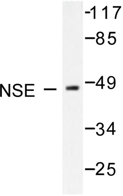 ENO2 / NSE Antibody (Arg400)