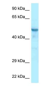 CCDC6 Antibody (aa56-105)