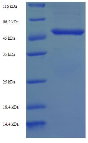 Human QPCT / QC Protein (Recombinant His-SUMO)