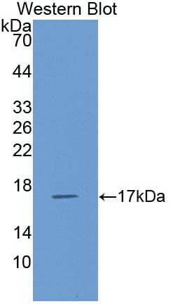 CCL5 / RANTES Antibody (aa24-91)
