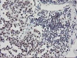 SENP2 Antibody (aa139-523, clone OTI3F5, Carrier-free)