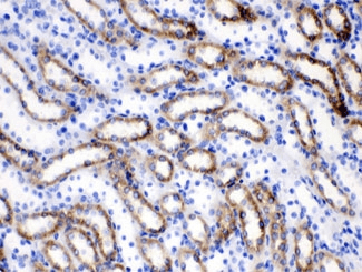 FACL2 / ACSL1 Antibody