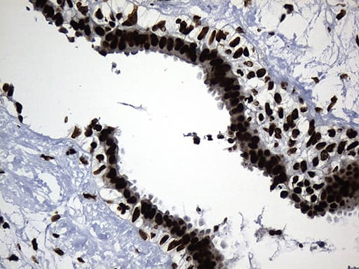 HNRNPH1 / hnRNP H Antibody (clone OTI2D11, Carrier-free)